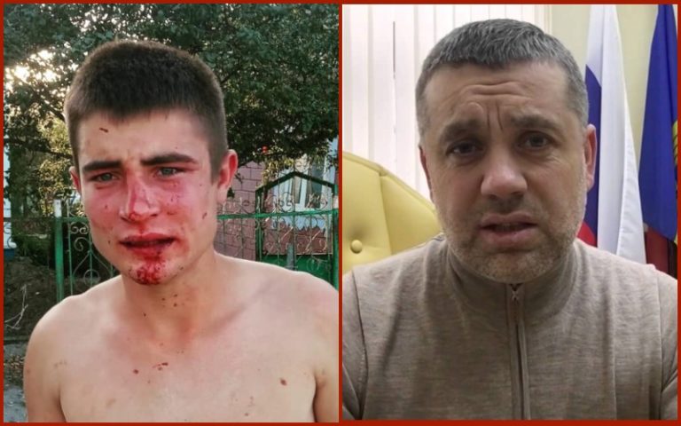 «Ни одна должность не стоит ни одной капли крови». Лидер «Партии регионов» отказался от участия в предвыборной гонке после избиения члена инициативной группы