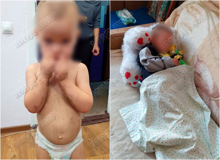 В Бендерах на дороге нашли двухлетнего малыша. Он был в грязи, голодный и с царапинами на теле