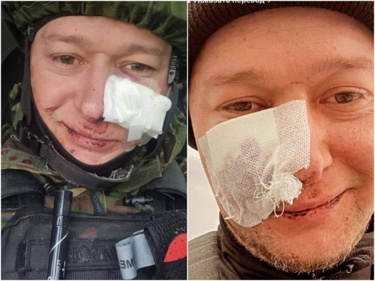 (ФОТО) Фронтмен группы «Бумбокс» Андрей Хлывнюк попал под минометный огонь