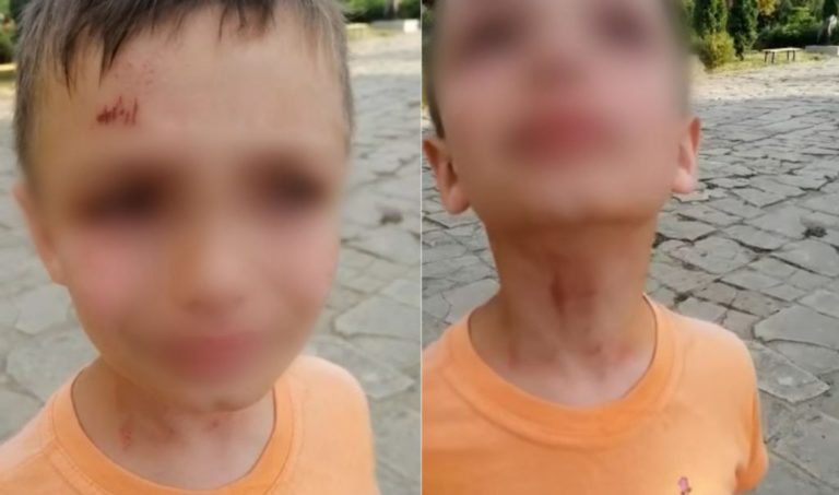 (ФОТО) Сотрудник пограничной полиции избил двух детей из Абаклии