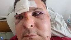 Николай Малышев избиение