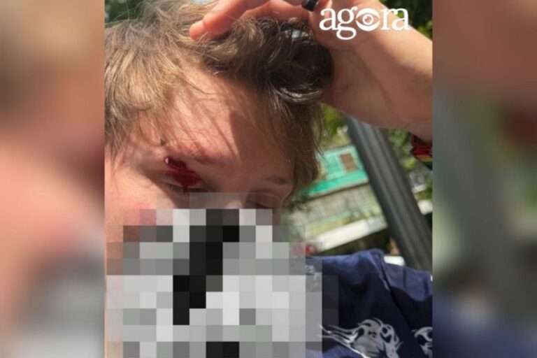 Участники ЛГБТ-марша в Кишинёве подверглись нападению